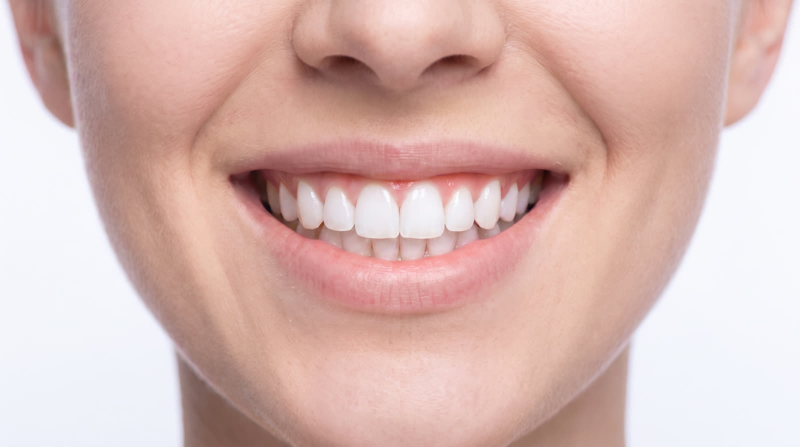 Visualisation of a smile after routine cleaning: brighter, whiter teeth